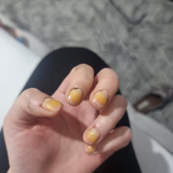 Flormar Oje Tırnakları Sarartıyor: Güven Sarsıcı Deneyim