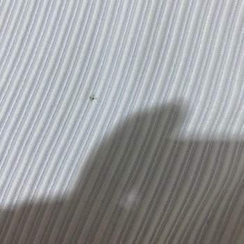 Yanlış Fiyat Ve Kusurlu Ürünle Gelen Hayal Kırıklığı