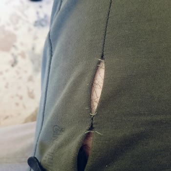 Kalitesiz Ürün Ve Müşteri Mağduriyeti