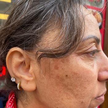 Nivea Yüz Bakım Kremi Alerjik Reaksiyona Sebep Oldu!