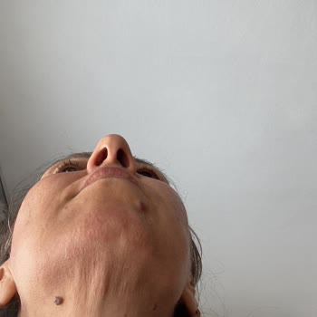 Nivea Yüz Bakım Kremi Alerjik Reaksiyona Sebep Oldu!