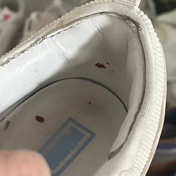 Puma Ayakkabılarının Sürekli Vurması Ve İade Sorunu