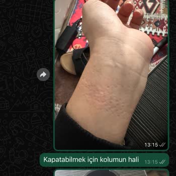 Kusurlu Ürün Ve İlgisiz Müşteri Hizmetleri