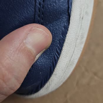 Adidas Ayakkabının Kalitesizliği Ve A101'in İlgisizliği