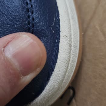 Adidas Ayakkabının Kalitesizliği Ve A101'in İlgisizliği