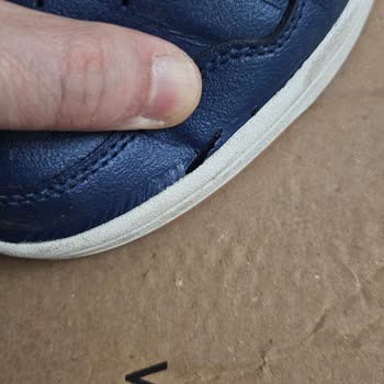 Adidas Ayakkabının Kalitesizliği Ve A101'in İlgisizliği