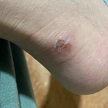 Dar Bot Ayağımı Mahvetti