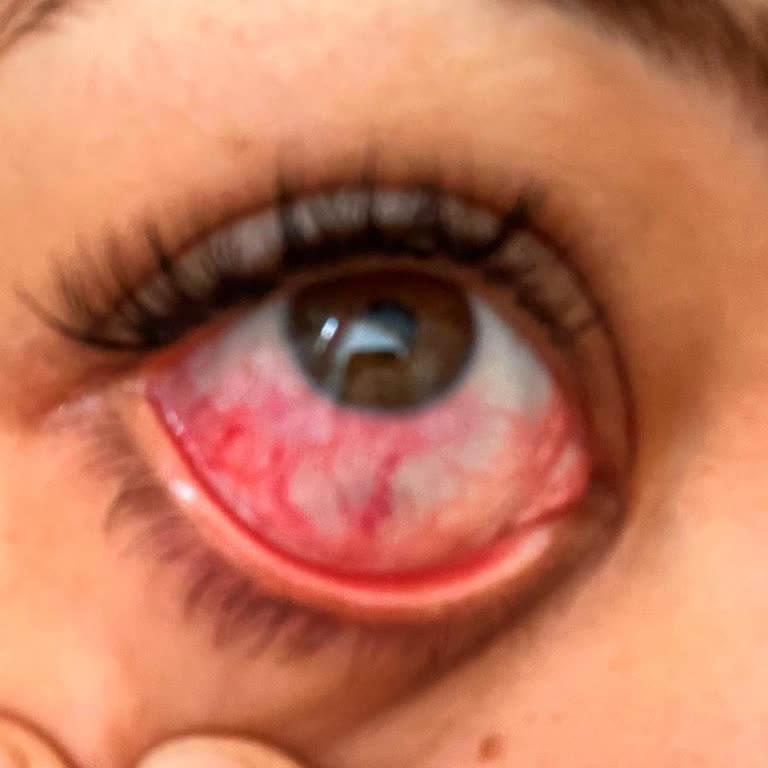 Güzellik Salonunda Alerji Ve İlgisizlik Deneyimi