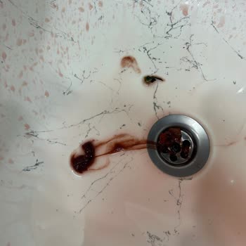 İçim Vişne Suyunda Beklenmedik Sorun ve İlgisizlik