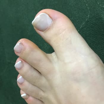 Eskişehir'de Hayal Kırıklığı: Tırnaklarım Ayakkabıda!