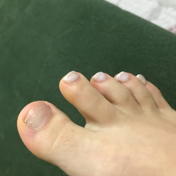 Eskişehir'de Hayal Kırıklığı: Tırnaklarım Ayakkabıda!