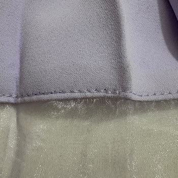 Yıpranan Etek Takımıyla Mağduriyet