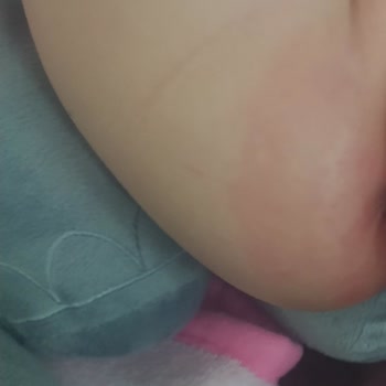 Sleepy Bebek Bezi Alerji Ve Sızdırma Sorunu