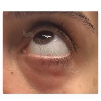 Estee Lauder Ürünleri Cilt Sorunlarına Yol Açtı