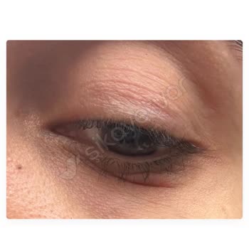 Estee Lauder Ürünleri Cilt Sorunlarına Yol Açtı