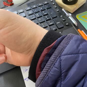 İç Astar Sorunu Ve Müşteri Memnuniyetsizliği