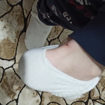 Vans Ayakkabılar Çocuğumun Ayağını Yaraladı