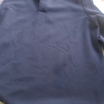 Boyner'den Aldığım Kazak Tiftiklendi Ve Destek Alamadım