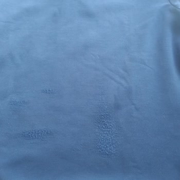 Boyner'den Aldığım Kazak Tiftiklendi Ve Destek Alamadım