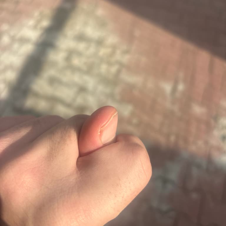 Yanlış Ürün Teslimatı Ve Müşteri Memnuniyetsizliği