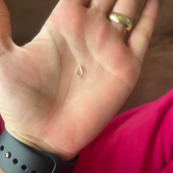 Nimet Patlıcanlı Rulo Börek İçinden Cam Parçası Çıktı