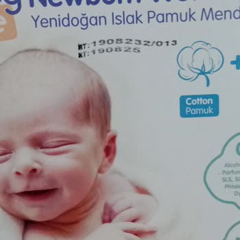 Yenidoğan Islak Mendil Köpüklü Çıktı, Kalite Düşüşü Üzdü