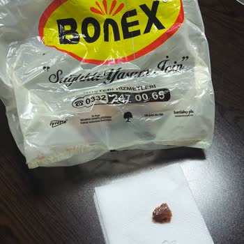 Yemekte Bulaşık Teli Şoku