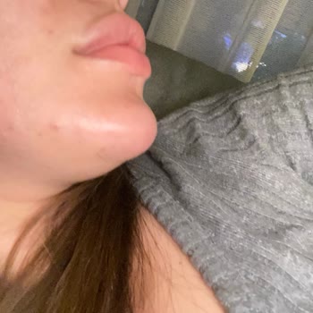 Dr. Ibragimova Lulduz İşlem İstediğim Gibi Olmadı!