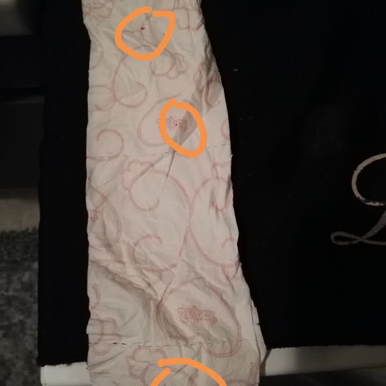 Selpak Tuvalet Kağıdındaki Kırmızı Lekeler