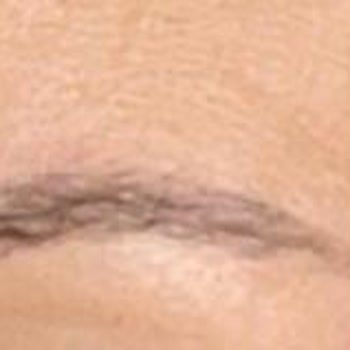 Özgür Kandemirli Beauty Microblading Sonrası Asimetrik Kaş Kabusu