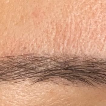 Özgür Kandemirli Beauty Microblading Sonrası Asimetrik Kaş Kabusu