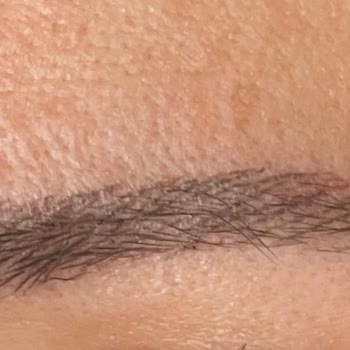 Özgür Kandemirli Beauty Microblading Sonrası Asimetrik Kaş Kabusu