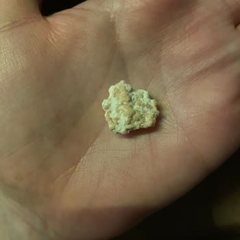 Sour Patch Jelibonunda Şaşırtan Yabancı Madde