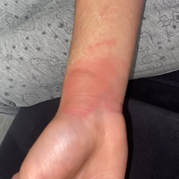 Starbucks Termos Patlaması: Müşteri Güvenliği Sorgulanıyor