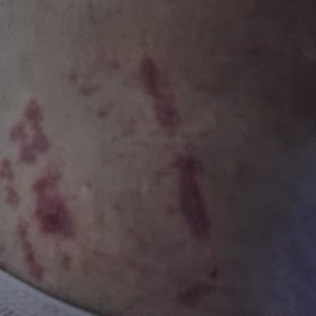 Annabella Güzellik Salonu'nda Deneyimsizlik Ve İhmalkarlık