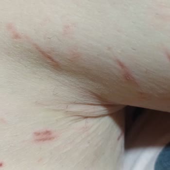 Annabella Güzellik Salonu'nda Deneyimsizlik Ve İhmalkarlık