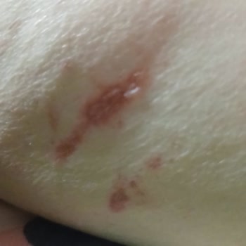 Annabella Güzellik Salonu'nda Deneyimsizlik Ve İhmalkarlık