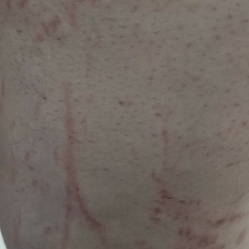 Annabella Güzellik Salonu'nda Deneyimsizlik Ve İhmalkarlık