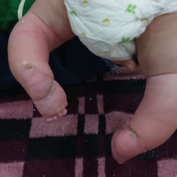 Yanlış Tedavi Ve Maddi Zorluklar Nedeniyle Mağduriyet