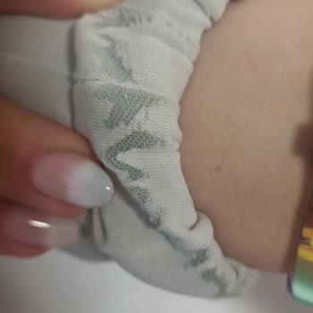 Renk Solması Ve Müşteri Hizmetleri Ulaşım Sorunu