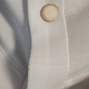 Renk Solması Ve Müşteri Hizmetleri Ulaşım Sorunu