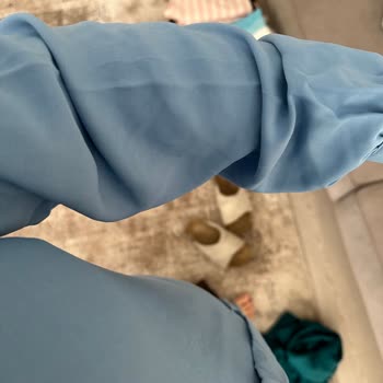 Yanıltıcı Ürün Rengi Ve Müşteri Hizmetleri Sorunu
