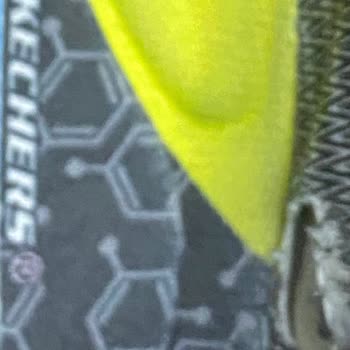 Skechers Ayakkabıda Erken Deformasyon Şikayeti