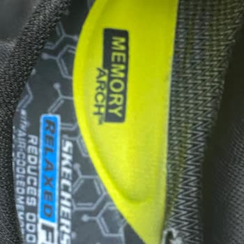 Skechers Ayakkabıda Erken Deformasyon Şikayeti