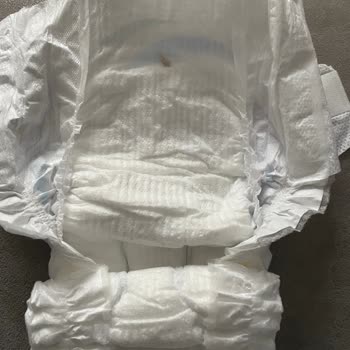 Molfix Bebek Bezinde Beklenmedik Sorunlar