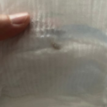 Molfix Bebek Bezinde Beklenmedik Sorunlar