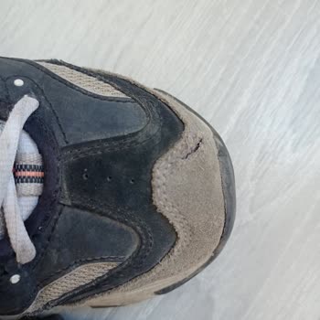 Skechers Ayakkabı Deformasyonu Ve Garanti Sorunu