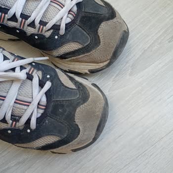 Skechers Ayakkabı Deformasyonu Ve Garanti Sorunu