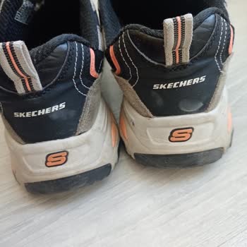 Skechers Ayakkabı Deformasyonu Ve Garanti Sorunu