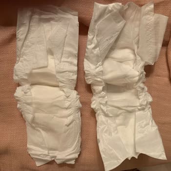 Kalite Düşüklüğü: Sleepy Bio Bebek Bezi Hayal Kırıklığı!